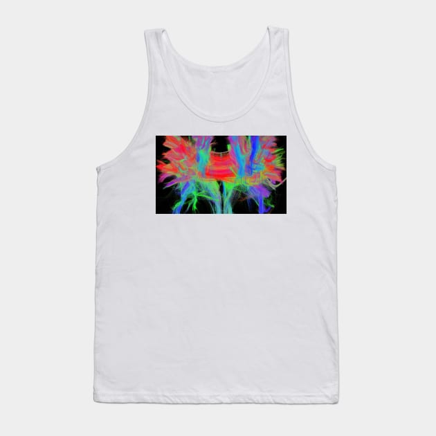 Corpus callosum, DTI MRI scan (C017/7044) Tank Top by SciencePhoto